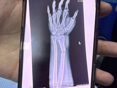金边发生交通事故后肇事逃逸，警方执法引发关注
